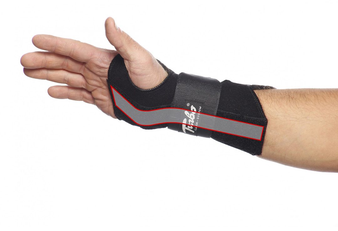 TurboMed wrist bandage - stabilizing orthosis to immobilize the hand