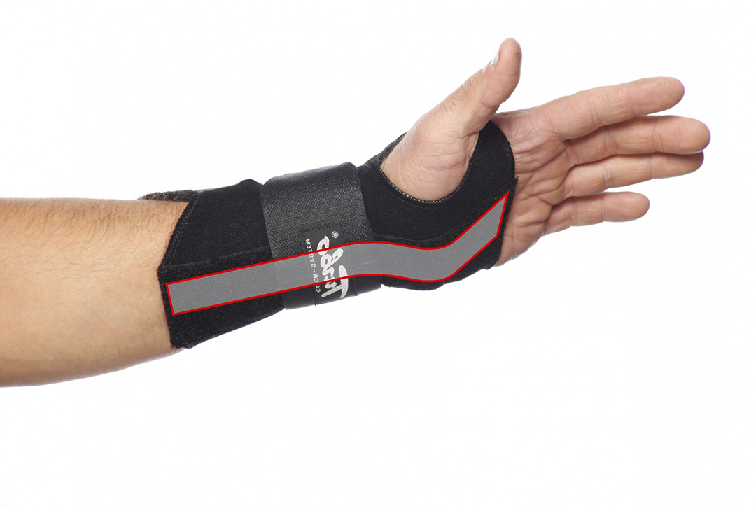 TurboMed wrist bandage - stabilizing orthosis to immobilize the hand